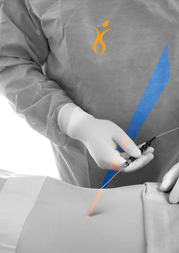 LIPOSUCTION (Liposakşın), YAĞ ALMA